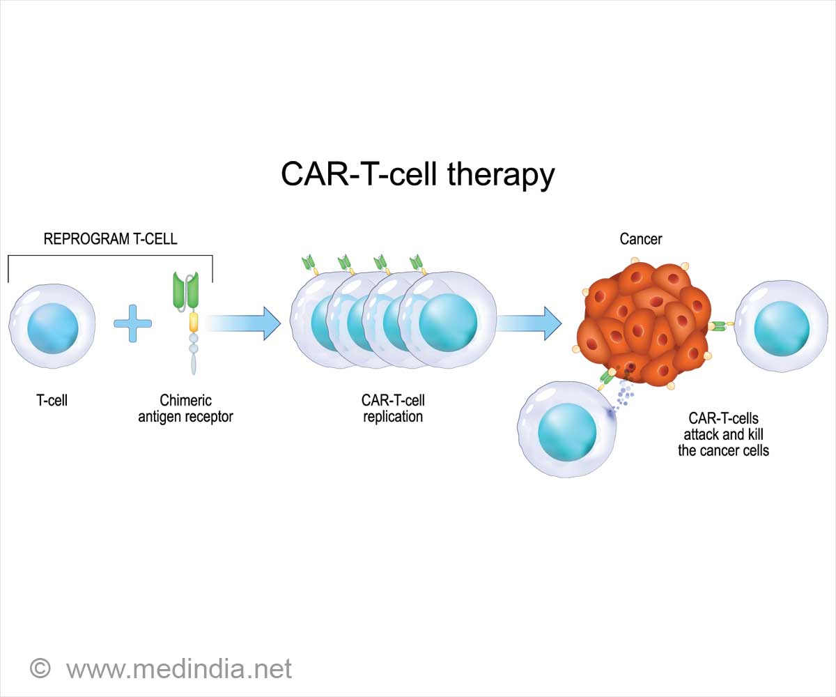 CAR T-Cell Therapy: FDA Warning on Secondary Cancer Risks