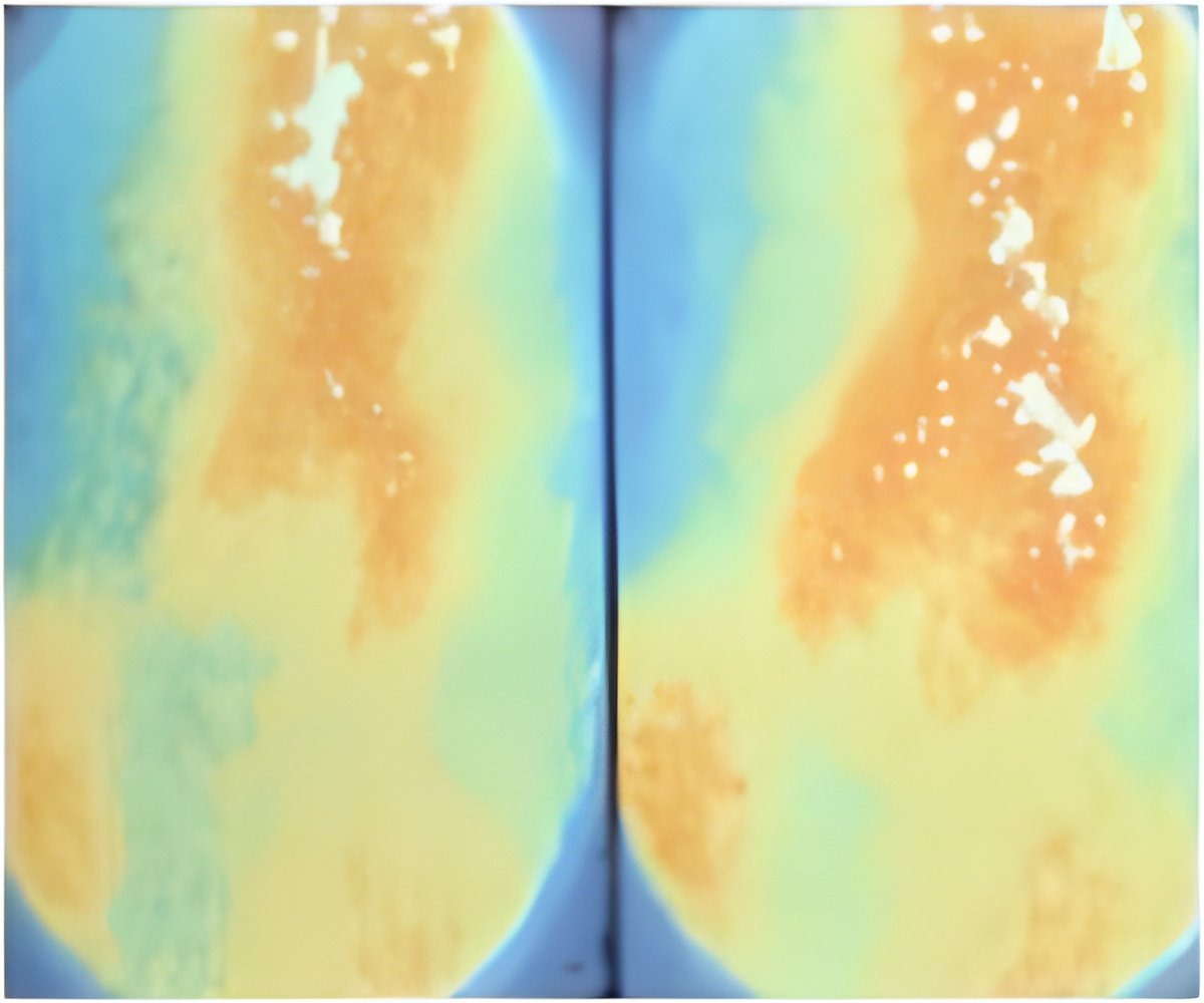 Researchers Are Developing An Antibody That Could Prevent Central Line Infection Researchers Are Developing An Antibody That Could Prevent Central Line Infection