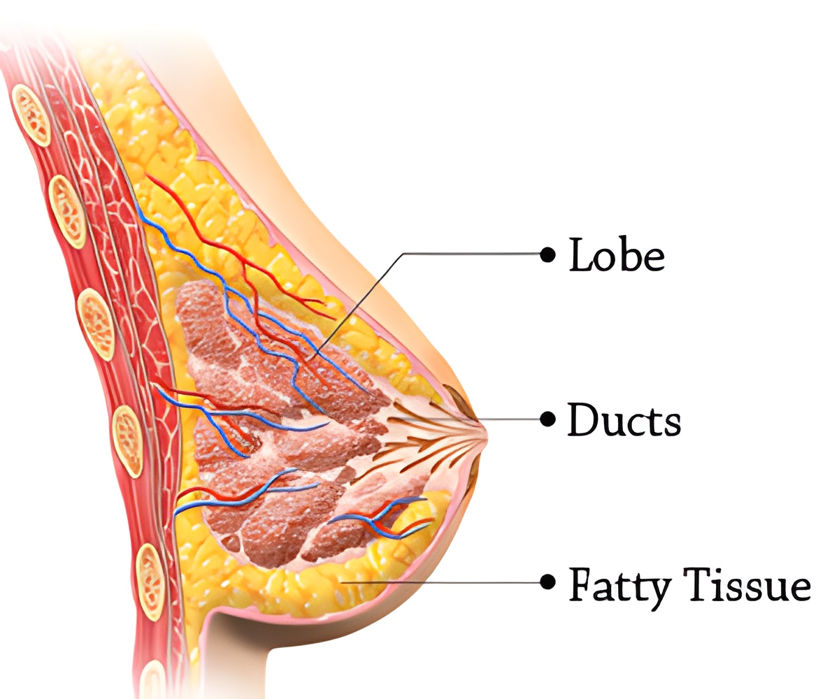 Silicone Breast Implants May Raise the Risk of Some Rare Disease