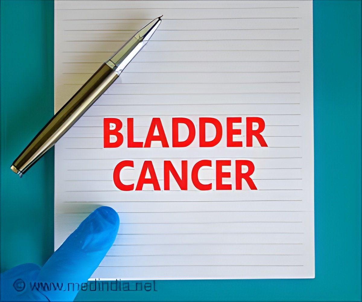 No Survival Achieve from Prolonged Lymph Node Removing in Bladder Most cancers