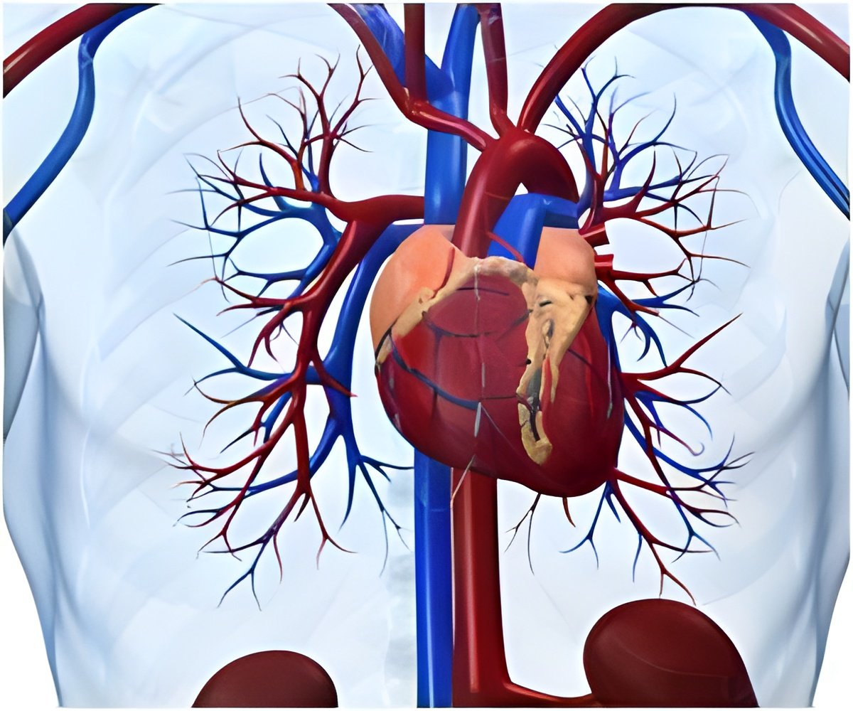 Employing Guidelines to Treat Chest Pain Got a Simple Strategies Boost Employing Guidelines to Treat Chest Pain Got a Simple Strategies Boost