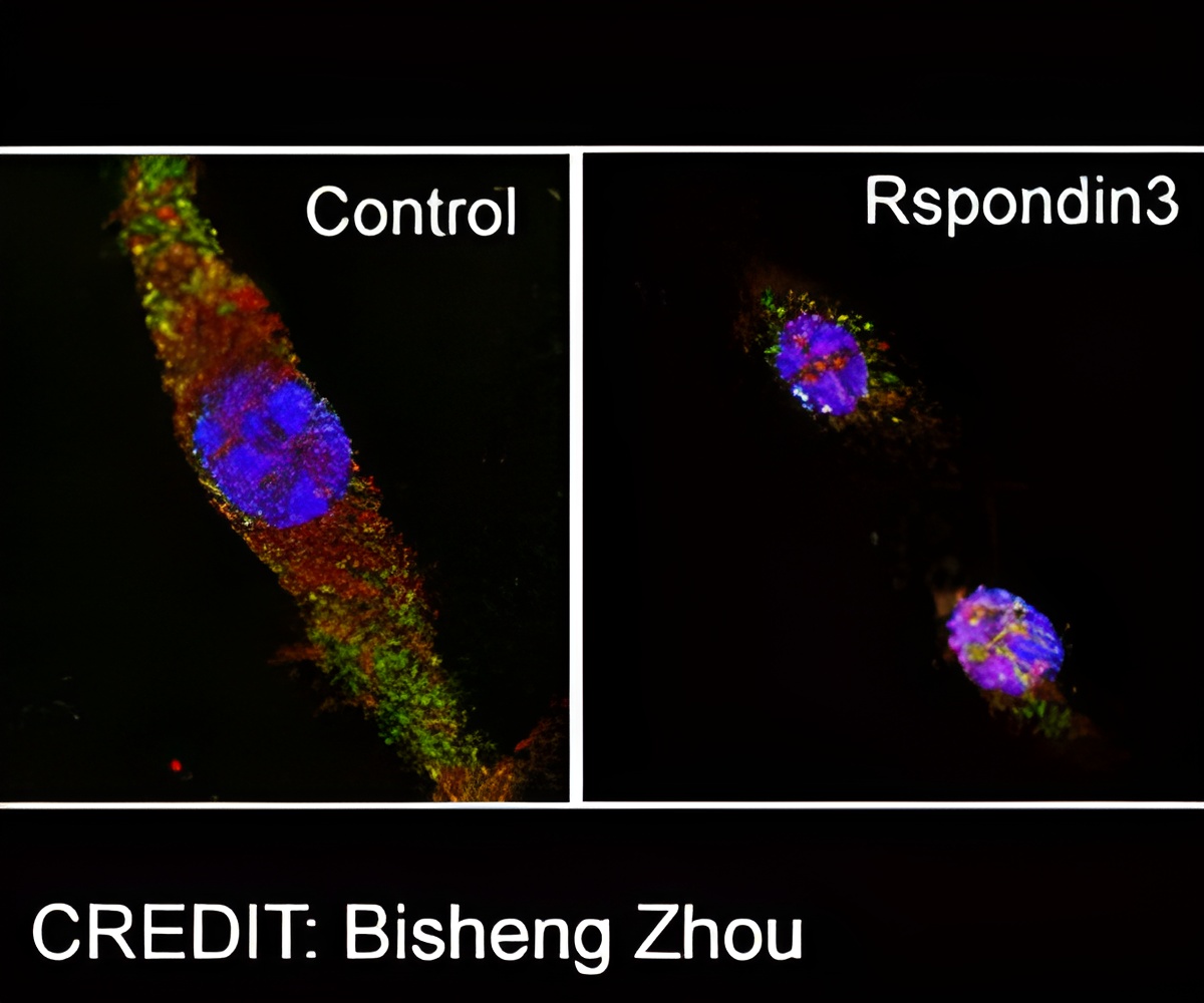 Reprogramming Immune Cells Promote Tissue Repair Reprogramming Immune Cells Promote Tissue Repair