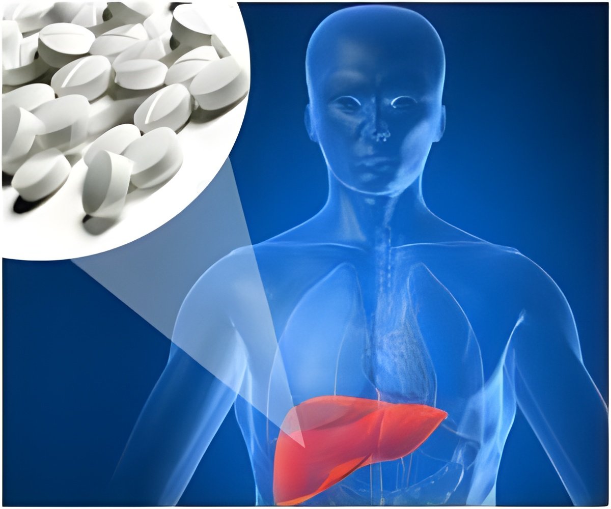 liver-damage-can-be-caused-by-popular-herbal-and-dietary-supplements