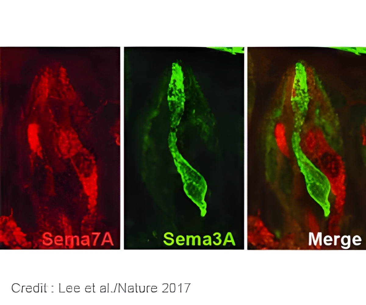 New Pathway Of Flavors Discovered Through Rewired Taste System New Pathway Of Flavors Discovered Through Rewired Taste System