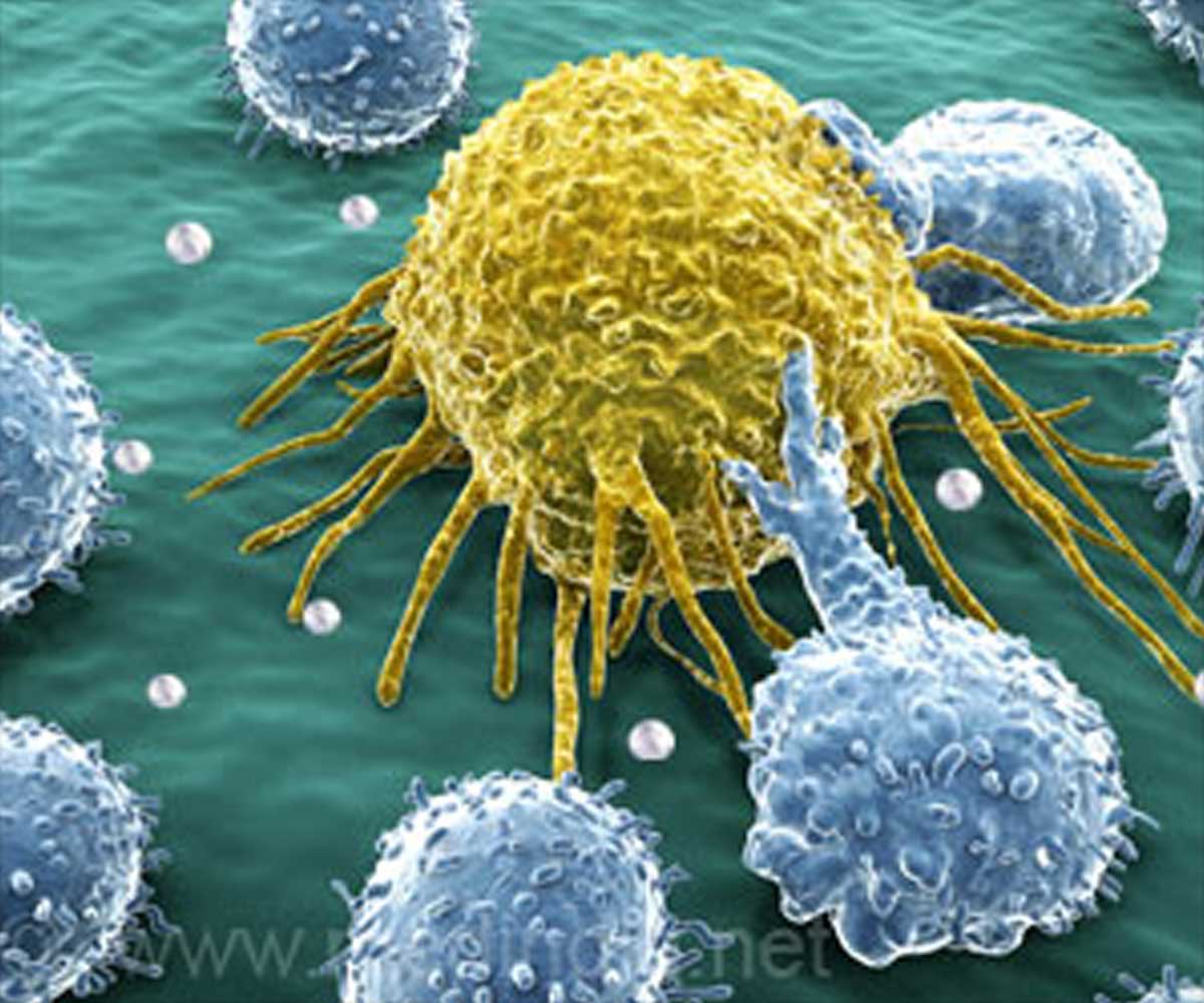 Pediatric Neuroblastoma Patients Face Higher Risk of Psychological Impairment Pediatric Neuroblastoma Patients Face Higher Risk of Psychological Impairment