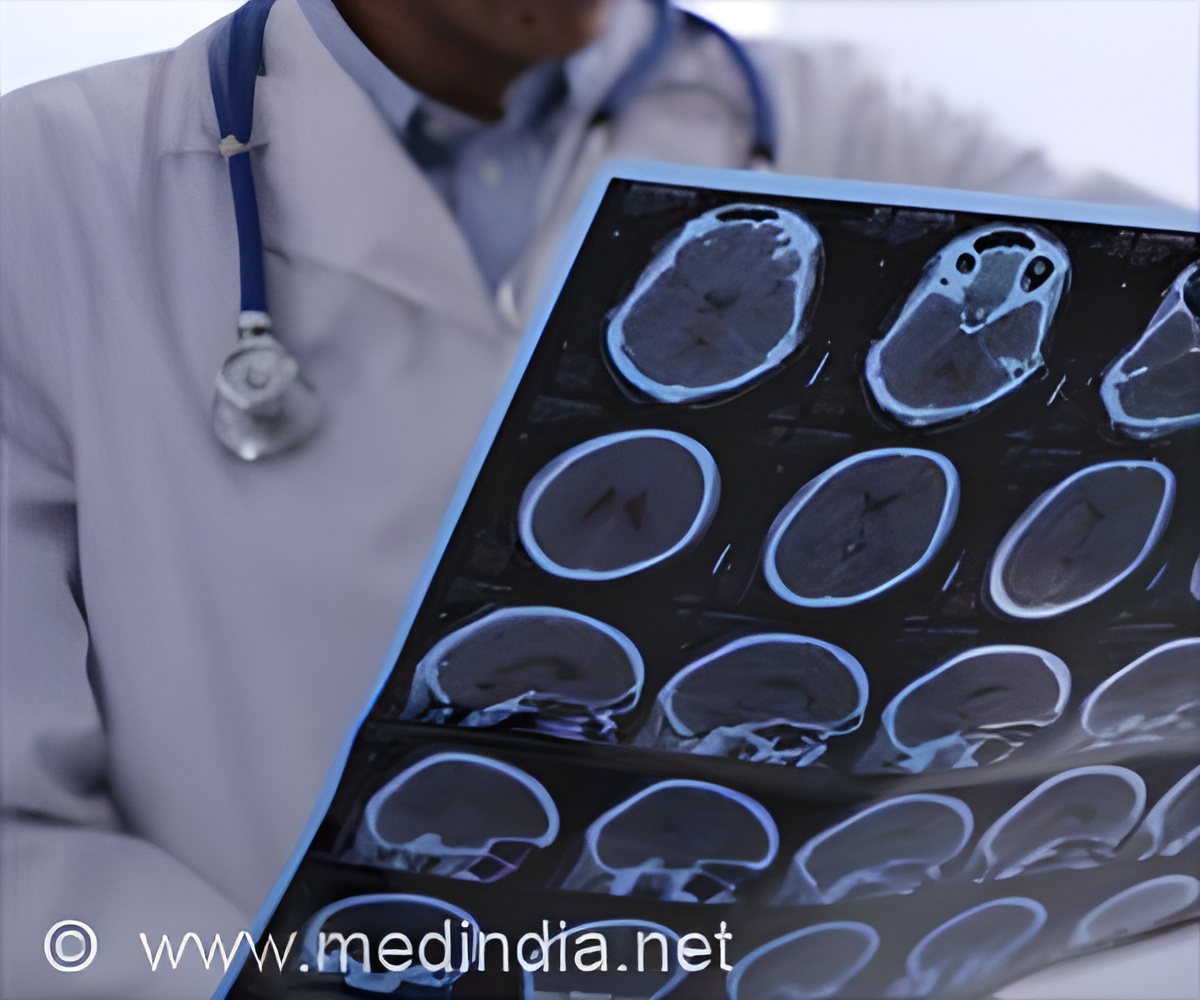 Women With Multiple Sclerosis Less Likely to Receive Timely Treatment