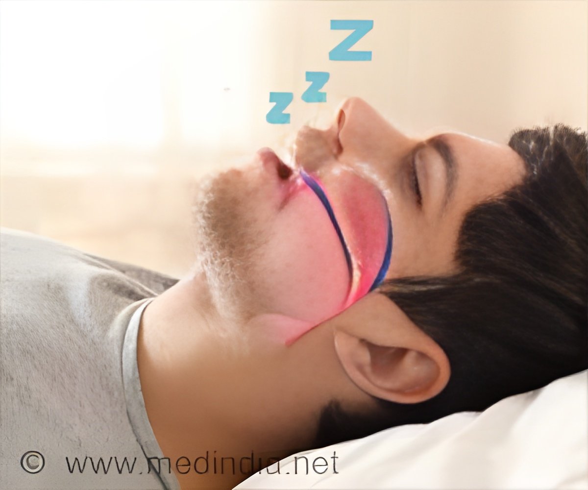 Nasal Spray's Potential in Treating Sleep Apnea