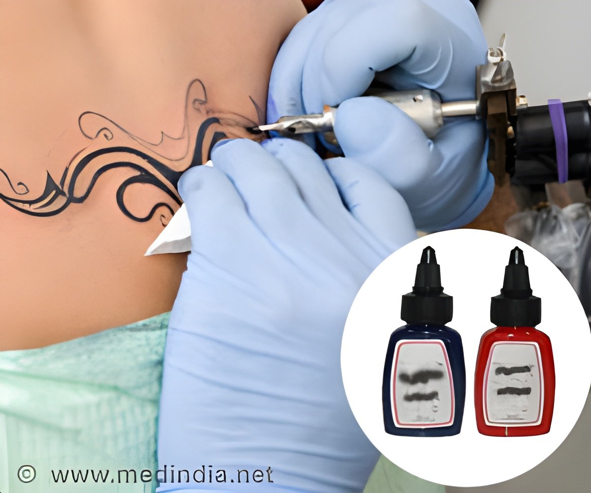 One Tattoo Ink Color Is More Likely to Cause Allergic Reactions Than Others