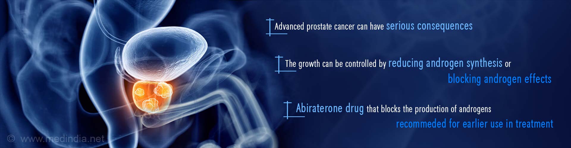 Advanced prostate cancer can have serious consequences
 The growth can be controlled by reducing androgen synthesis or blocking androgen effects
 Abiraterone drug that blocks the production of androgens recommended for earlier use in treatment