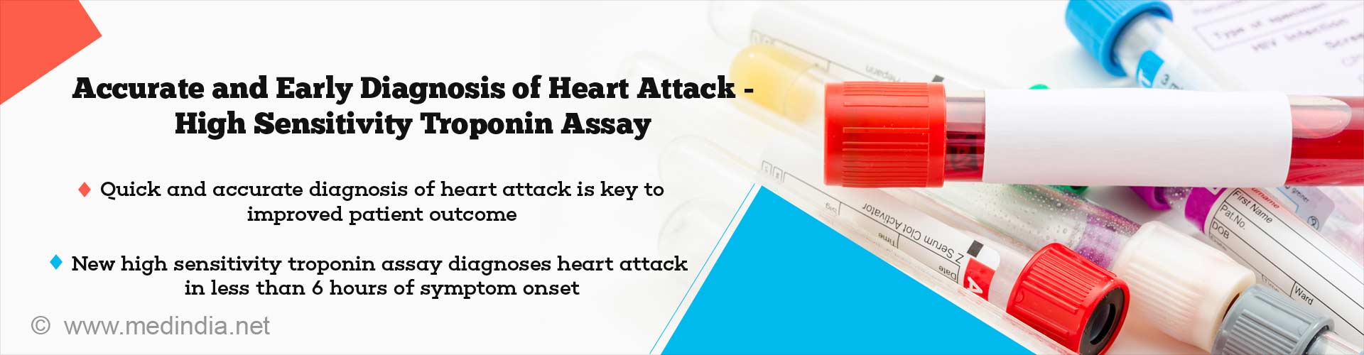 Accurate and early diagnosis of heart attack - High sensitivity troponin assay
- quick and accurate diagnosis of heart attack is key to improved patient outcome
- new high sensitivity troponin assay diagnoses heart attack in less than 6 hours of symptom onset