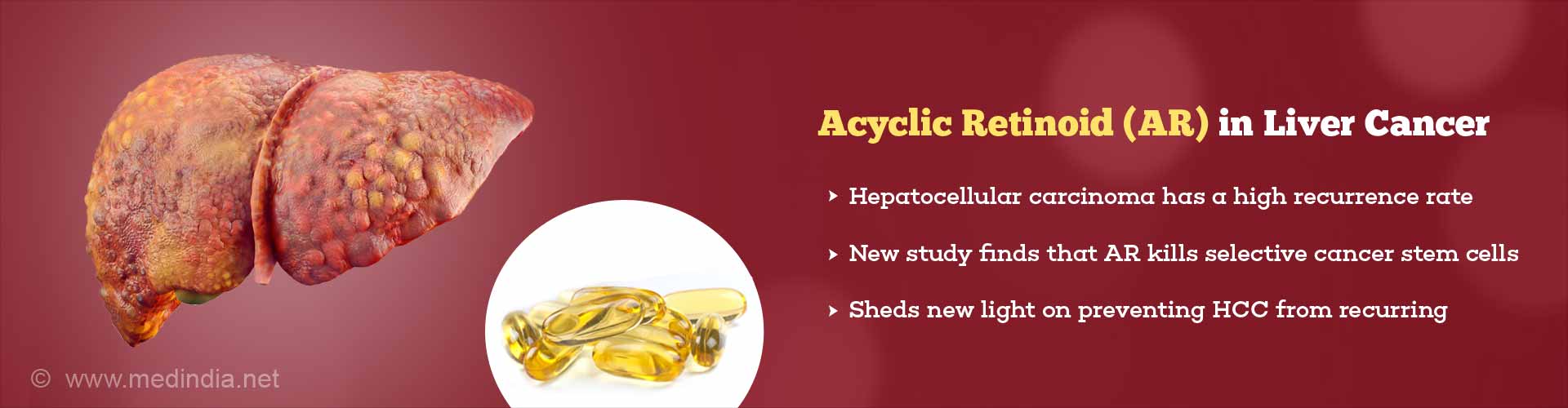 acyclic retinoid (AR) in liver cancer
- hepatocellular carcinoma has a high recurrence rate
- new study finds that AR kills selective cancer stem cells
- sheds new light on preventing HCC from recurring