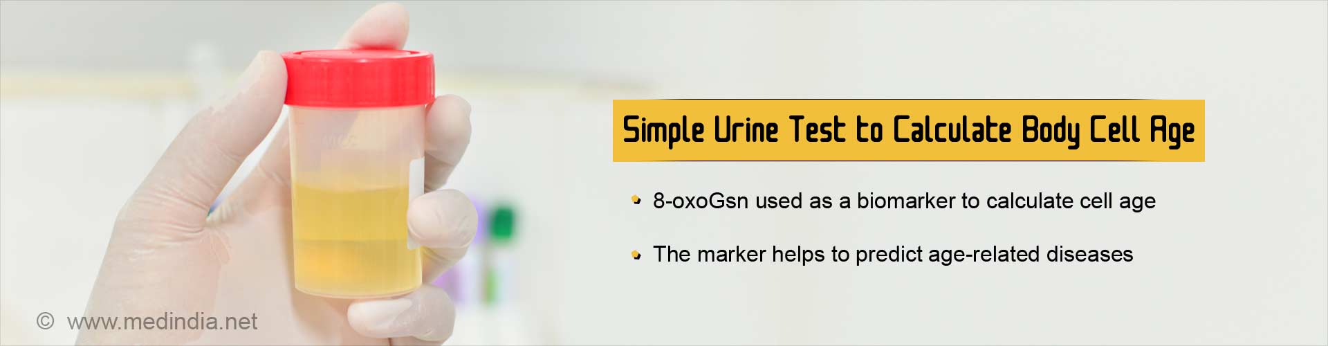 simple urine test to calculate body cell age
- 8-oxoGsn used as a biomarker to calculate cell age
- the marker helps o predict age-related diseases