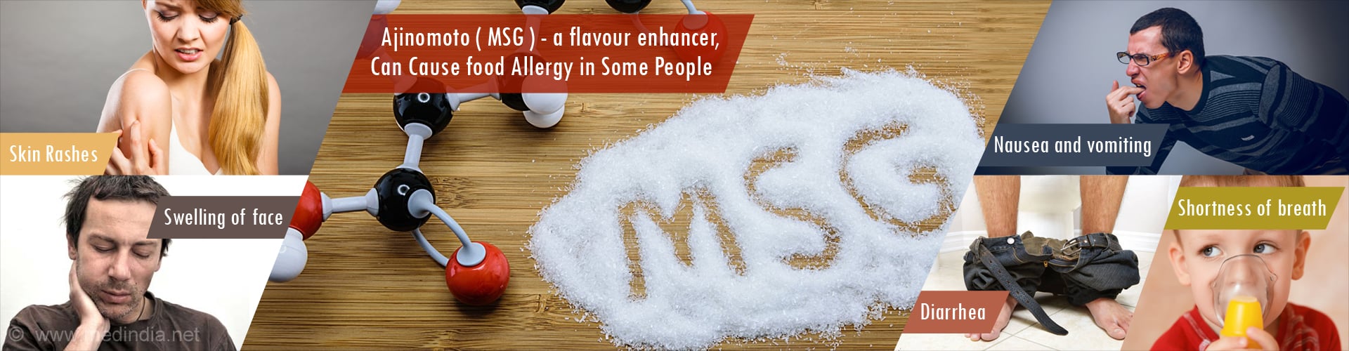 Ajinomoto ( MSG ) - a flavour enhancer,  Can Cause food Allergy in Some People