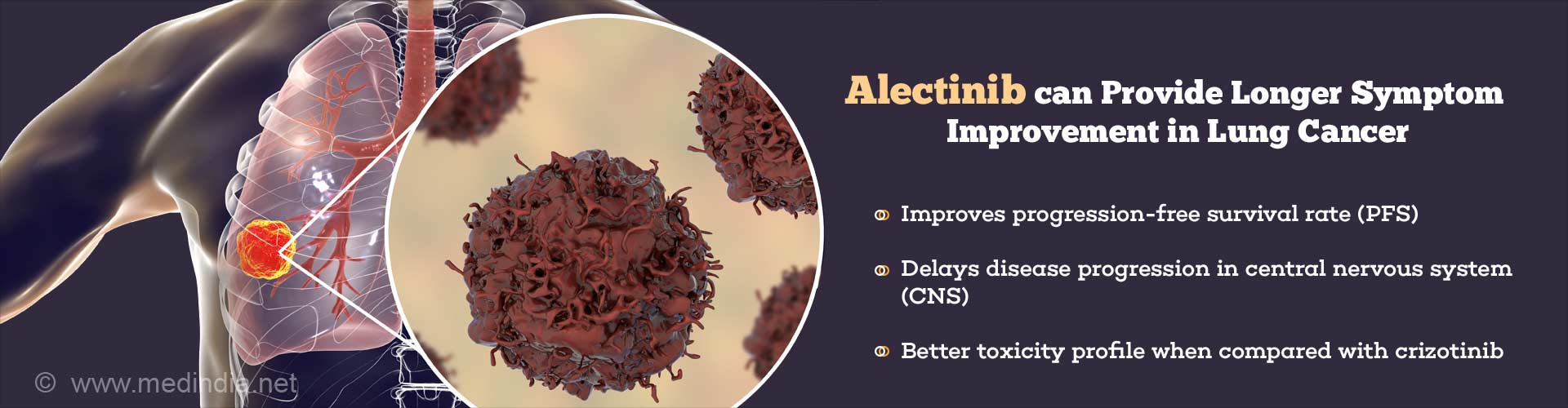 alectinib can provide longer symptom improvement in lung cancer
- improves progression-free survival rate (PFS)
- delays disease progression in central nervous system (CNS)
- better toxicity profile when compared with crizitinib