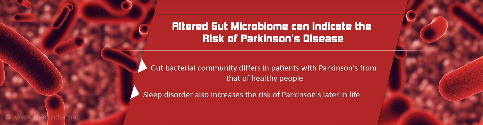 Altered gut microbiome can indicate the risk of Parkinson's disease
- Gut bacterial community differs in patients with Parkinson's from that of healthy people
- Sleep disorder also increases risk of Parkinson's later in life