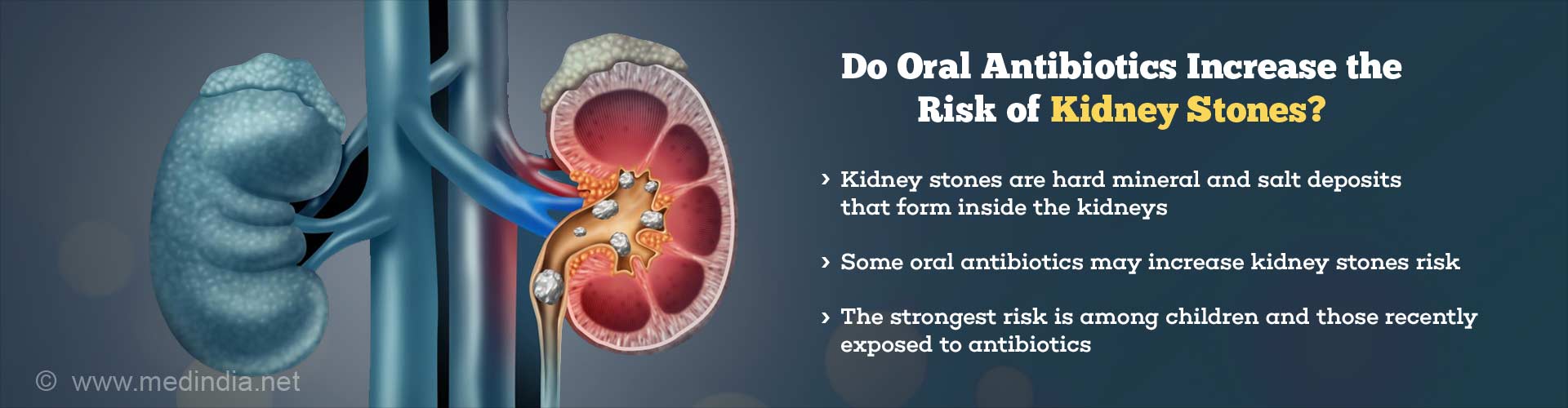 Do Oral Antibiotics Increase the Risk of Kidney Stones?
Kidney stones are hard mineral and salt deposits that form inside the kidneys
Some oral antibiotics may increase kidney stones risk
The strongest risk is among children and those recently exposed to antibiotics