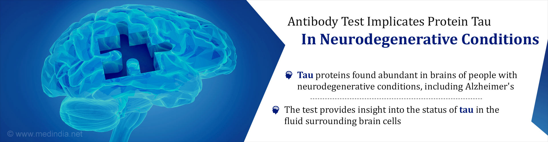 Antibody test implicates protein tau in neurodegenerative conditions
- Tau proteins found abundant in brains of people with neurodegenerative conditions, including Alzeimer''s
- The test provides insight into status of tau in the fluid surrounding brain cells