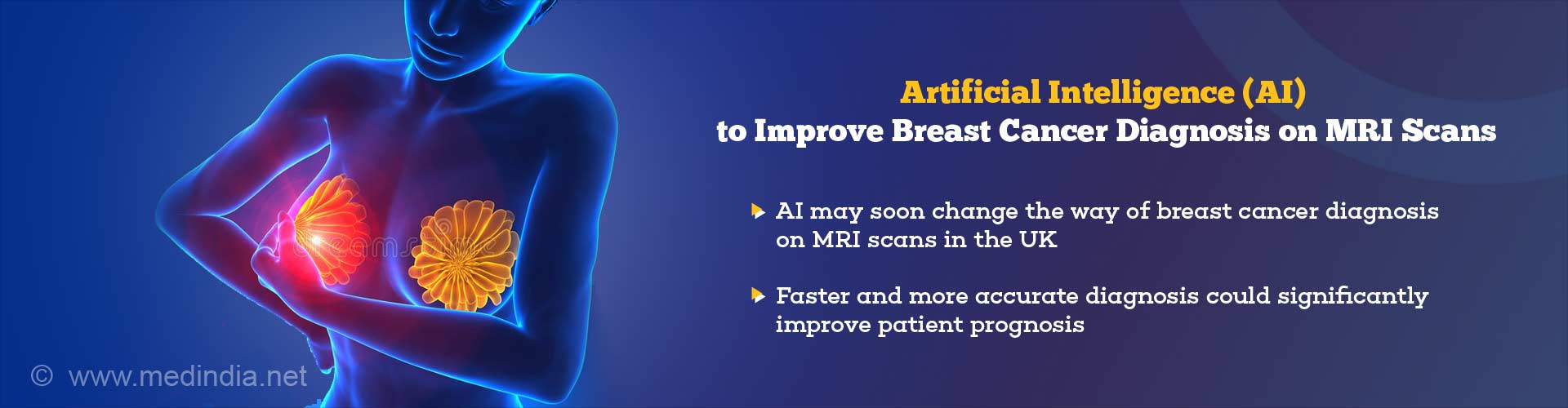 artificial intelligence (ai) to improve breast cancer diagnosis on mri scans
- ai may soon change the way of breast cancer diagnosis on mri scans in the UK
- faster and more accurate diagnosis could significantly improve patient prognosis