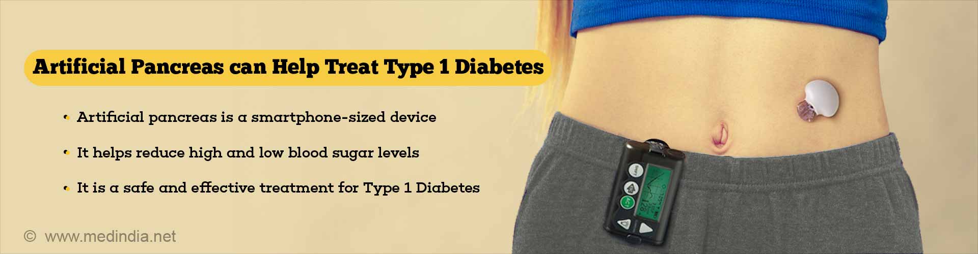 Artificial pancreas can help treat type 1 diabetes
- artificial pancreas is a smartphone-sized device 
- it helps reduce high and low blood sugar levels
- it is a safe and effective treatment for type 1 diabetes