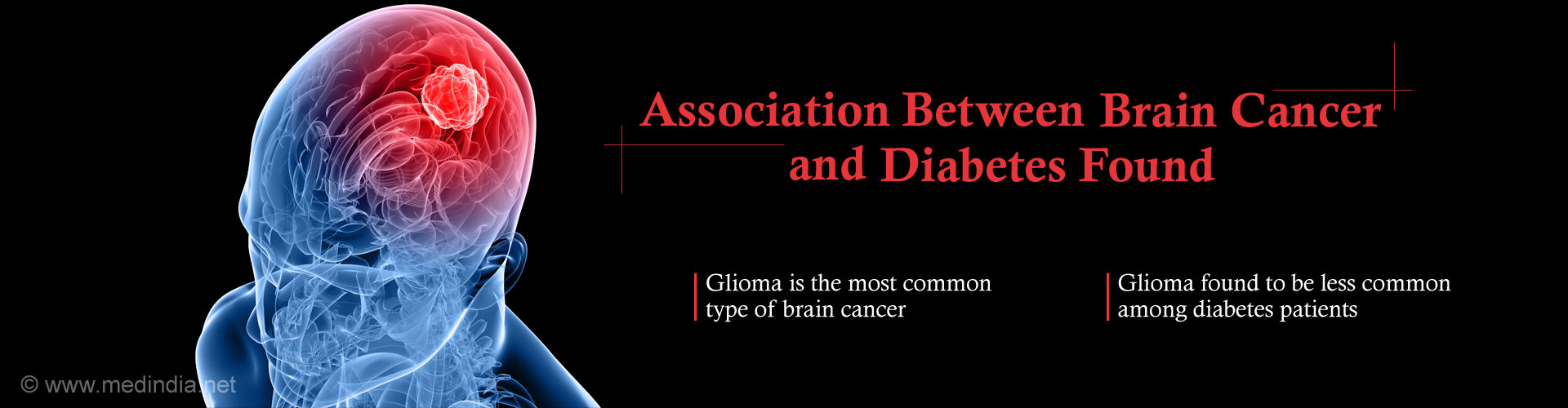 Association between brain cancer and diabetes found
- Gliome is most common type of brain cancer
- Glioma found to be less common among diabetes patients