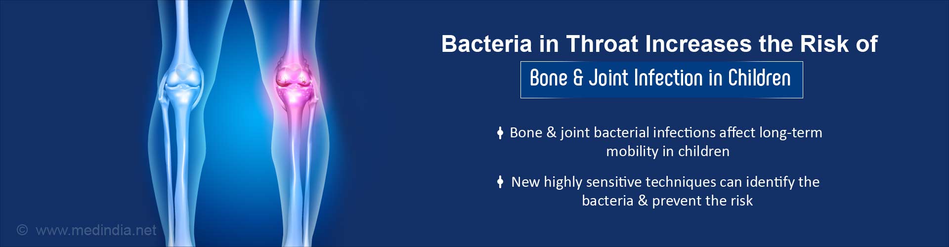 bacteria in throat increases the risk of bone & joint infection in children
- bone & joint bacterial infections affect long-term mobility in children
- new highly sensitive techniques can identify the bacteria & prevent the risk