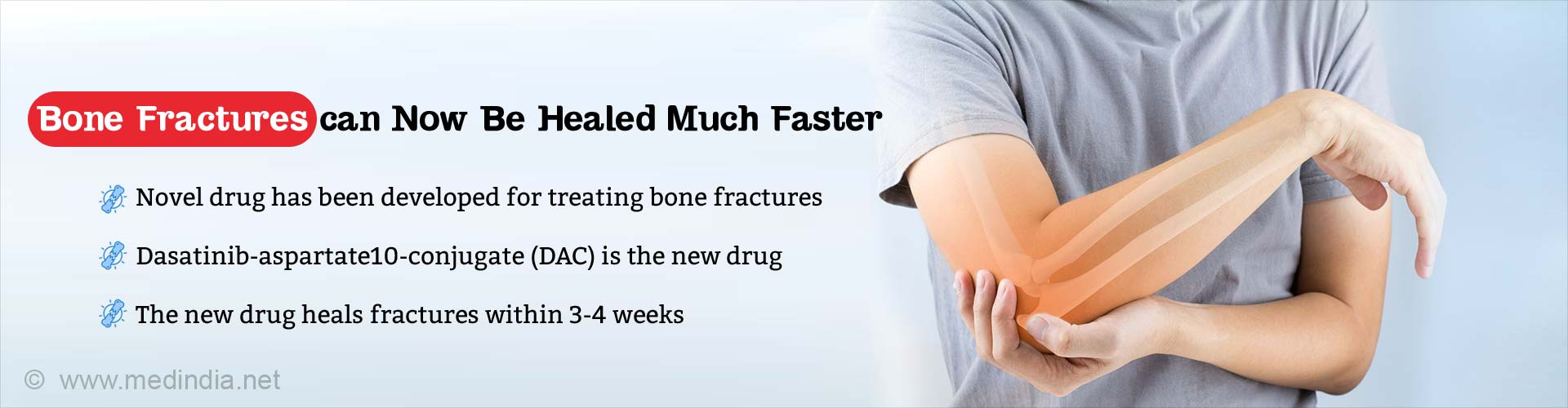 Bone fractures can now be healed much faster. Novel drug has been developed for treating bone fractures. Dasatinib-aspartate10-conjugate (DAC) is the new drug. The new drug heals fractures within 3-4 weeks.
