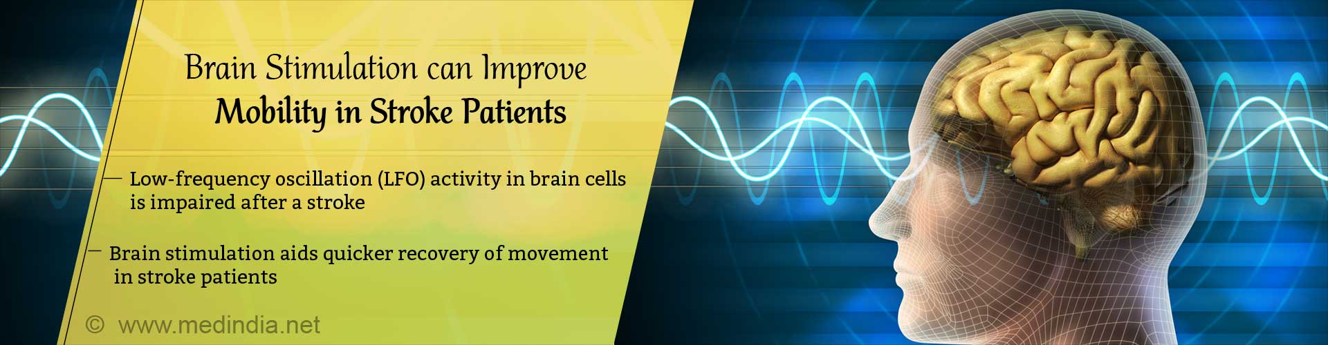 Brain stimulation can improve mobility in stroke patients. Low-frequency oscillation (LFO) activity in brain cells is impaired after a stroke. Brain stimulation aids quicker recovery of movement in stroke patients. 