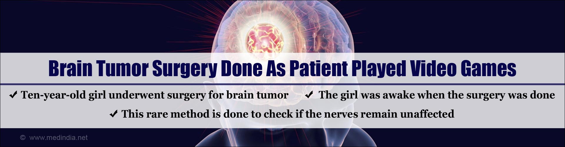 Brain tumor surgery done as patient played video video games
- Ten-year-old girl underwent surgery for brain tumor
- the girl was awake when the surgery was done
- The rare method is done to check if the nerves remain unaffected