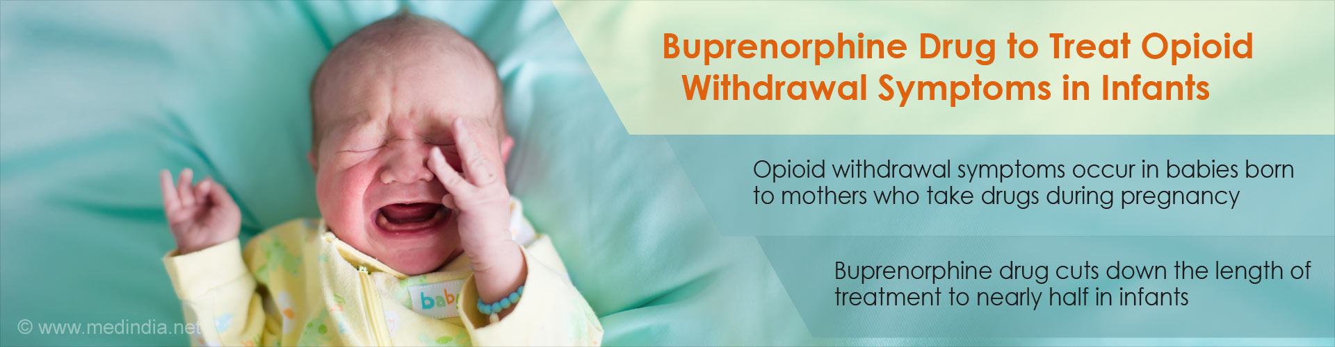 Buprenorphine drug to treat opioid withdrawal symptoms in infants
- Opioid wihdrawal symptoms occur in babies born to mothers who take drugs during pregnancy
- Buprenorphine drug cuts down the length of treatment to nearly half in infants