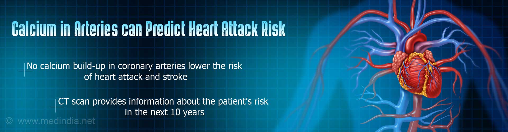 Calcium in arteries can predict heart attack risk
- no calcium build-up in coronary arteries lower the risk of heart attack and stroke
- CT scan provides information about the patient''s risk in the next 10 years