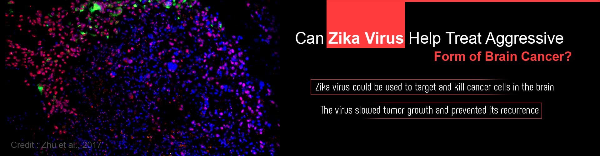 can zika virus help treat aggressive form of brain cancer?
- zika virus could be used to target and kill cancer in the brain
- the virus slowed tumor growth and prevented its recurrence