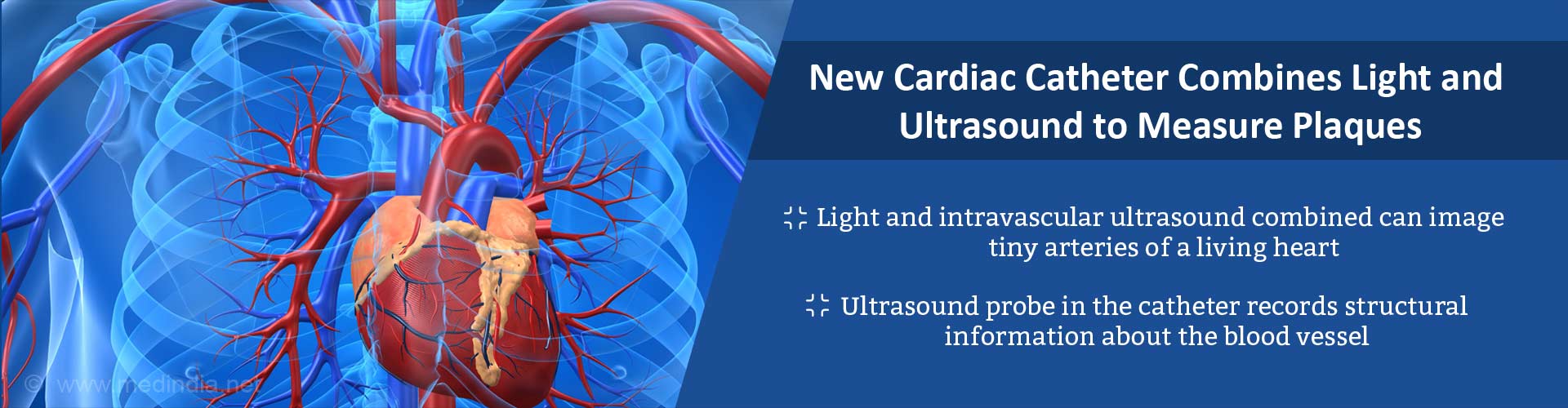 New cardiac catheter combines light and ultrasound measure plaques
- Light and intravascular ultrasound combined can image tiny arteries of a living heart
- Ultrasound probe in the catheter records structural information about the blood vessel