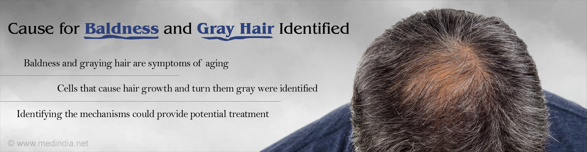 Cause for Baldness and Gray Hair Identified
- Baldness and graying hair are symptoms of aging
- Cells that cause hair growth and turn them gray were identified
- Identifying the mechanisms could provide potential treatment