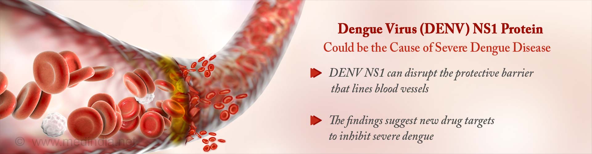 dengue virus (DENV) NS1 protein could be the cause of severe dengue disease
- (DENV) NS1 can disrupt the protective barrier that lines blood vessels
- The findings suggest new drug targets to inhibit severe dengue
