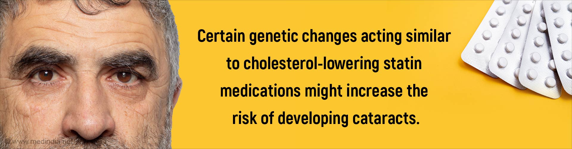 Do Cataracts Go Up When Cholesterol Goes Down?
