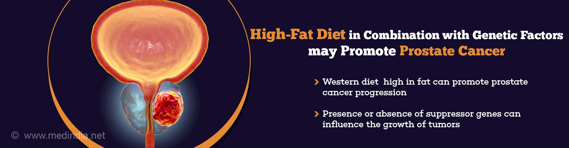 How High-Fat Diet may Promote Prostate Cancer
