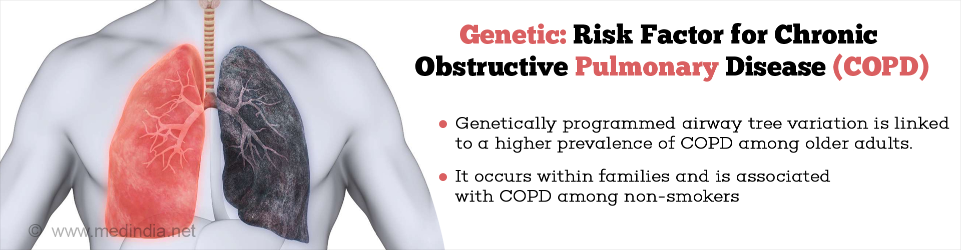 Health Tip On Genetic Variations Can Help Identify Risk For Chronic ...