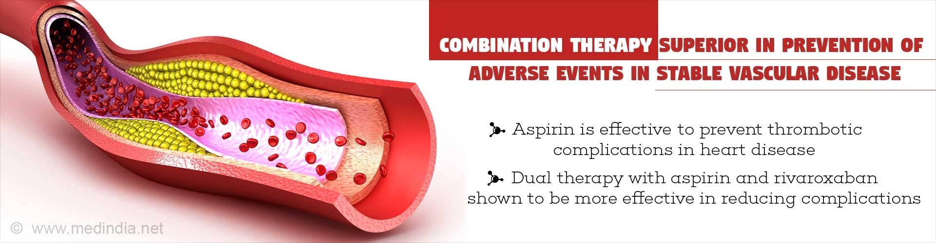 Combination therapy superior in prevention of adverse events in stable vascular disease
- Aspirin is effective to prevent thrombotic complications in heart disease
- Dual therapy with aspirin and rivaroxaban shown to be more effective in reducing complicaions