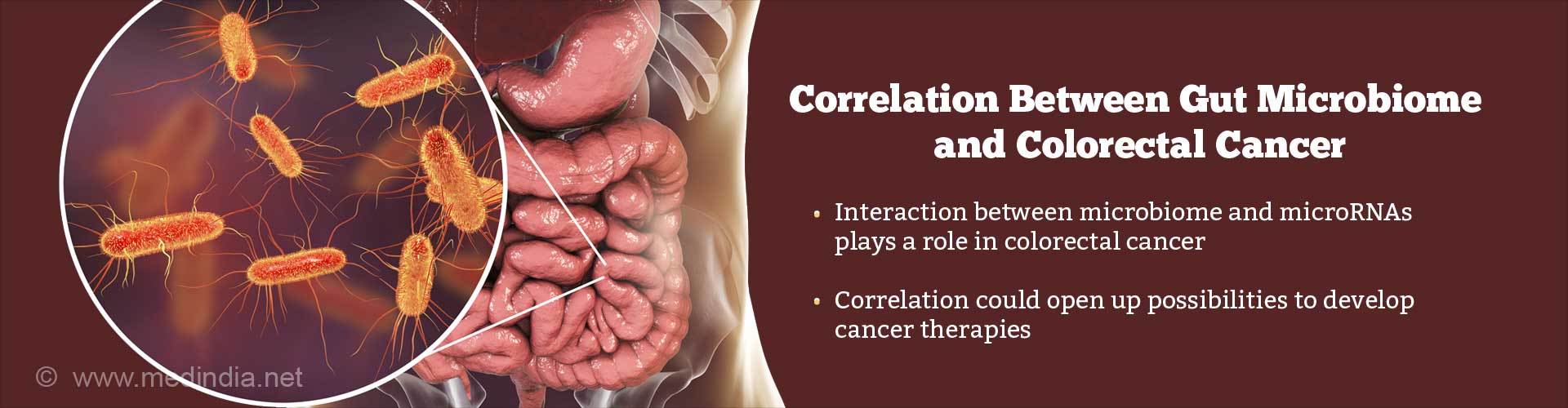 correlation between gut microbiome and colorectal cancer
- interaction between microbiome and microRNAs play a role in colorectal cancer
- correlation could open up possibilities to develop cancer therapies