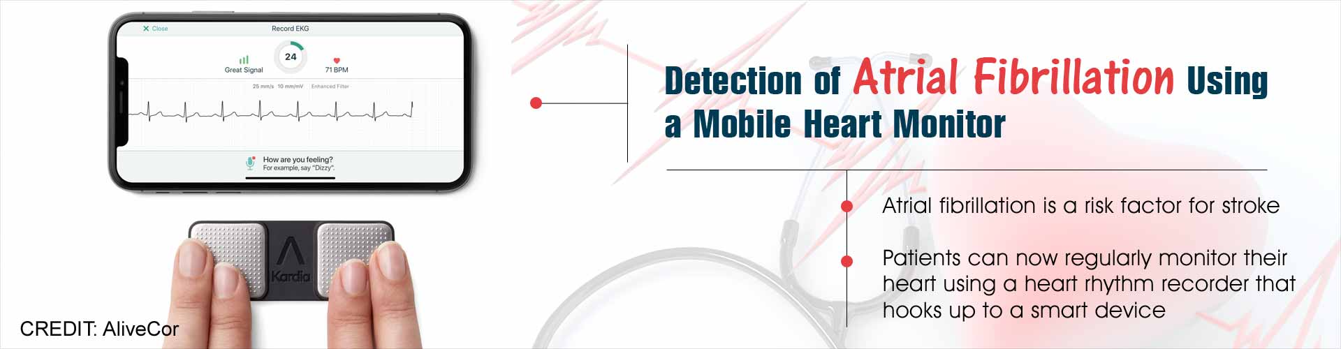 Detection of atrial fibrillation using a mobile heart monitor. Atrial fibrillation is a risk factor for stroke. Patients can now regularly monitor their heart using a heart rhythm recorder that hooks up to a smart device.
