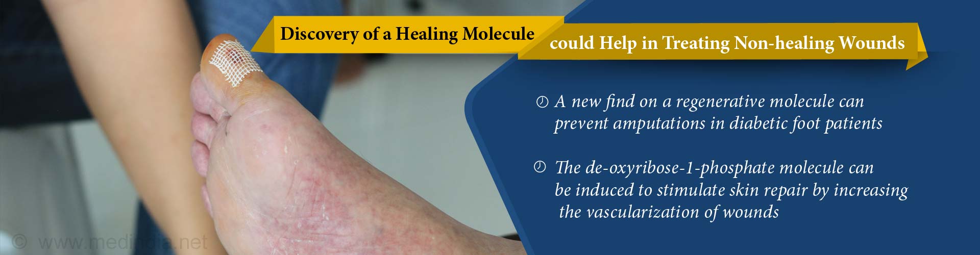 New Healing Molecule to Reduce Diabetic Limb Amputations