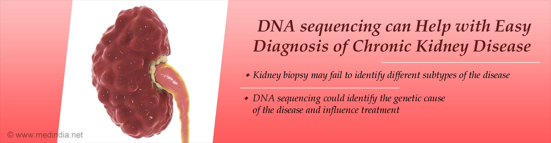 DNA sequencing can help with easy diagnosis of chronic kidney disease
- kidney biopsy may fail to identify different subtypes of the disease
- DNA sequencing could identify the genetic cause of the disease and influence treatment
