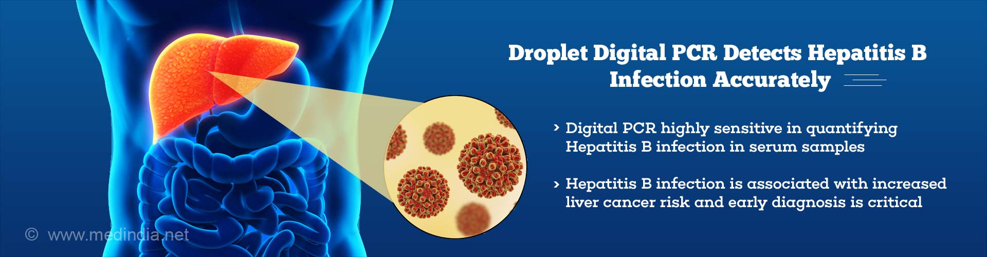 Droplet Digital Polymerase Chain Reaction (PCR) to Detect Hepatitis B Infection