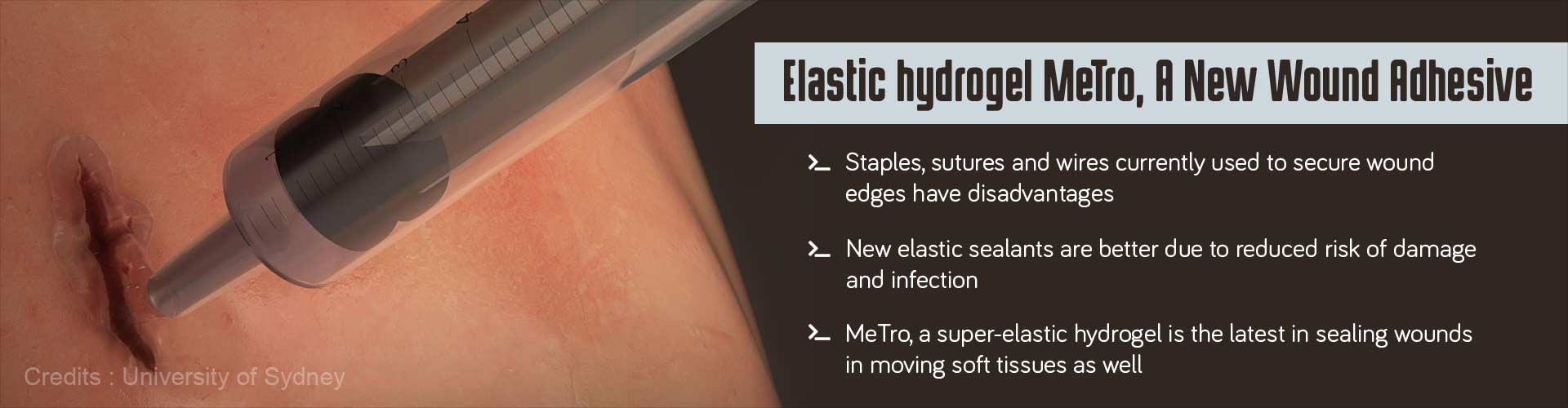 Elastic hydrogel MeTro, a new wound adhesive
- Staples, sutures and wires currently used to secure wound edges have disadvantages
- New elastic sealants are better due to reduced risk of damage and infection
- MeTro, a super-elastic hydrogelis the latest in sealing wounds in moving soft tissues as well