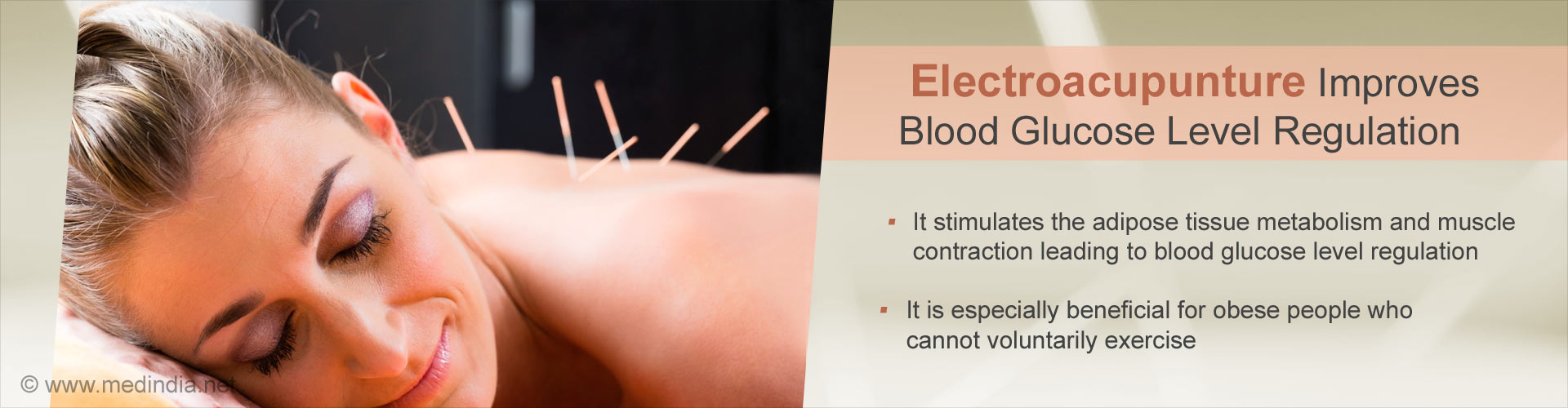 Electro-acupunture improves blood glucose level regulation
- It stimulates the adipose tissue metabolism and muscle contraction leading to blood glucose level regulation
- It is especially beneficial for obese people who cannot voluntarily exercise