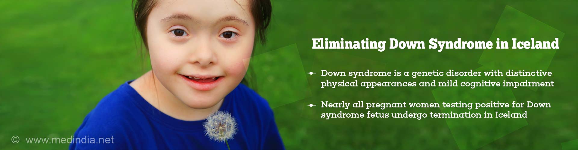 Eliminating Down Syndrome in Iceland
- Down syndrome is a genetic disorder with distinctive physical appearance and mild cognitive impairment
- Nearly all pregnant women testing positive for Down syndrome fetus undergo termination in Iceland