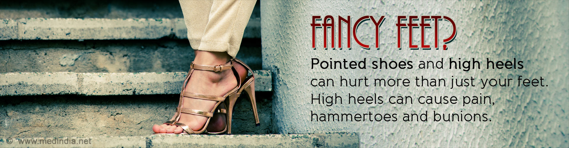 Fancy Feet? Pointed Shoes and High Heels can Hurt More Than just Your Feet. High heels can cause pain, hammertoes and bunions.