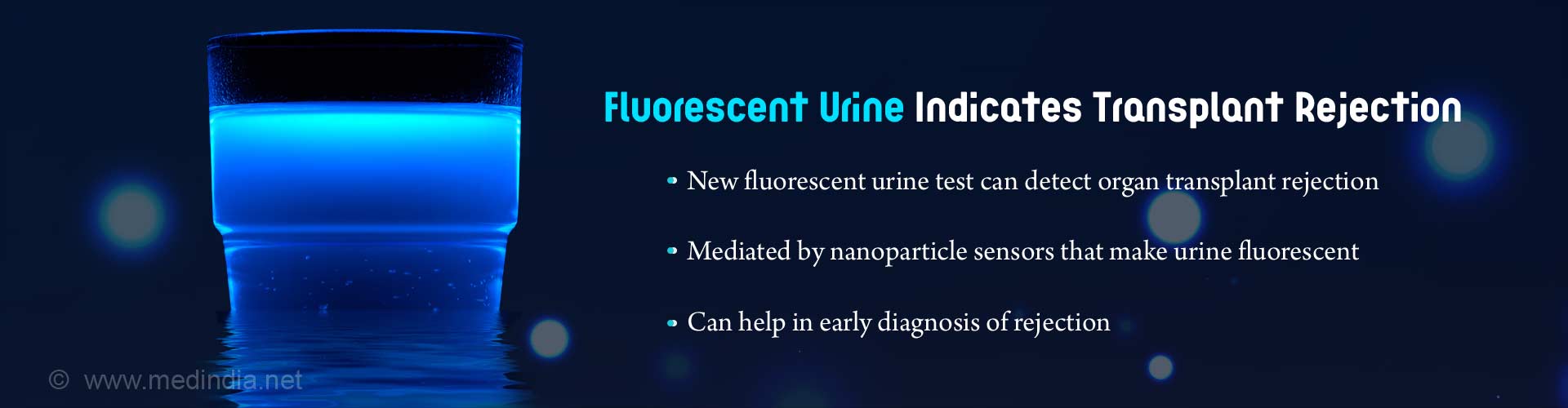 Fluorescent urine indicates transplant rejection. New fluorescent urine test can detect organ transplant rejection. Mediated by nanoparticle sensors that make urine fluorescent. Can help in early diagnosis of rejection.