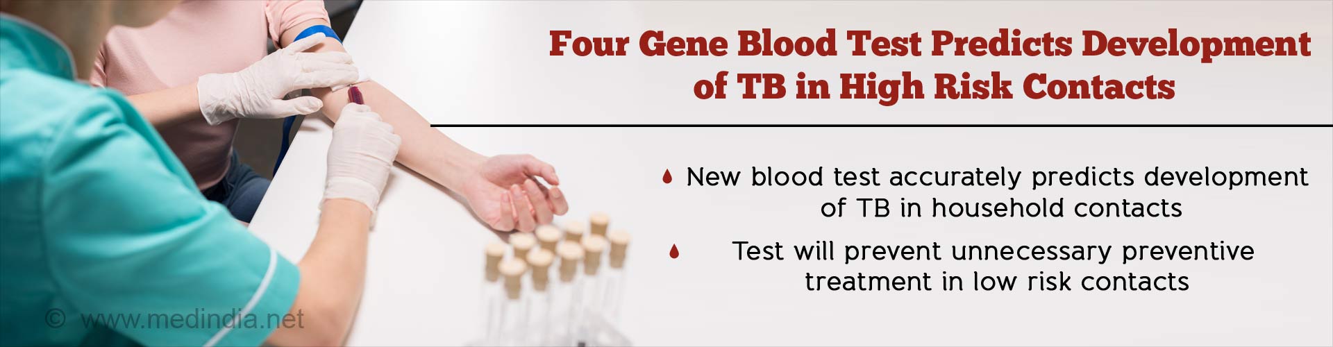 four gene blood test predicts development of TB in high risk contacts
- new blood test accurately predicts development of TB in household contacts
- test will prevent giving unnecessary preventive treatment in low risk contacts