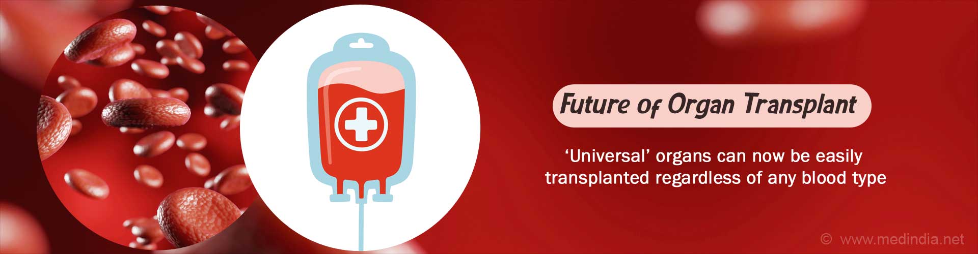 Organ Transplantation Can Now be Done Using Universal Blood Type Organs